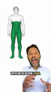 Anterior Spinal Cord Syndrome : How to Diagnose a Spinal Cord Infarct