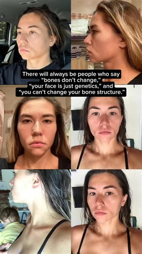 Face & Body rejuvenation on Instagram: "I get comments all the time saying “bones don’t change.” But here’s what people forget: A) Bones do change — they naturally resorb with age. It’s part of the aging process. B) And even more importantly: the angle and position of the bones change. Not the bone material — the geometry. That’s what shapes your face… and that’s what we can influence. With the right posture work, fascial release, cranial mobility, and facial exercises, people see changes in 1–2