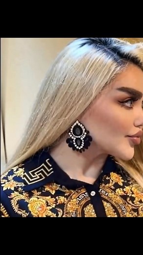 She had 43 cosmetic procedures to become a "REAL" Barbie Doll. But just wait until you see how she looked before the surgeries 😮 photo in comments👇 | Oran Ten