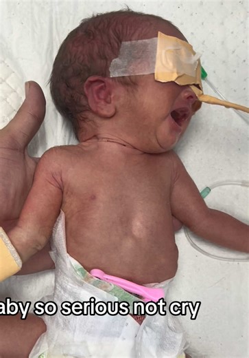 Adorable NICU Baby: Serious Yet Cute