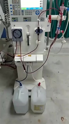 Hemodialysis Machine: Principles, Components, and Operational MechanismA hemodialysis machine is an advanced biomedical system designed to replace essential renal functions in patients with acute or chronic kidney failure. Its primary role is to remove metabolic waste products, excess electrolytes, and surplus water from the bloodstream while maintaining physiological homeostasis. The system operates by circulating the patient’s blood through an extracorporeal circuit connected to a dialyzer (ar