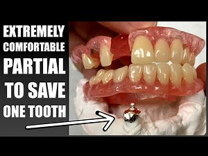 FULL PROCESS: Extraordinary Effort to Make Unbreakable Flexi-Partial