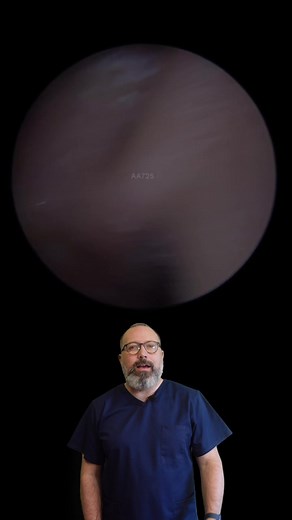 Fungal Ear Infection (Otomyocosis) Removal - Part 1