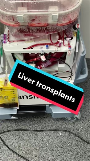 Liver Transplant Setup Guide