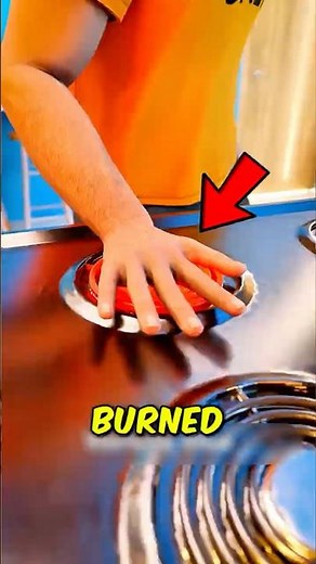 Burned Your Hand? 😳 Don’t Put Ice On It!