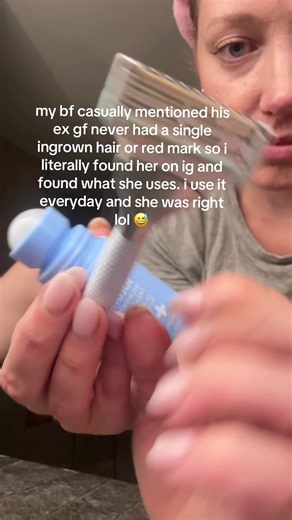 she was right #ingrownhair #shavingbumps #ingrownhairs #bfrelatable #couplegoals
