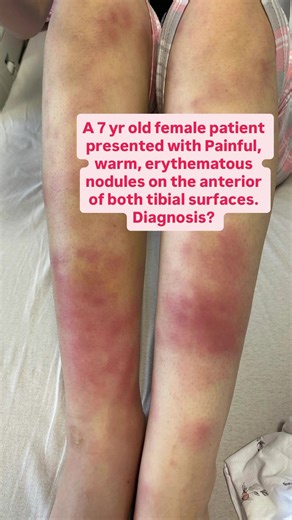 Pediatric dermatology case! Real one #shorts #educational #dermatology