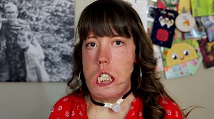 Hannah is a disabled mom who adopted four kids with her loving husband, Brandon. She wants the world to know that they are not heroes for adopting, they just knew that many kids in the world need a home and they have room and love to give. | Special Books by Special Kids