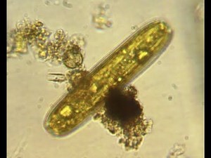 How to prepare a wet mount.