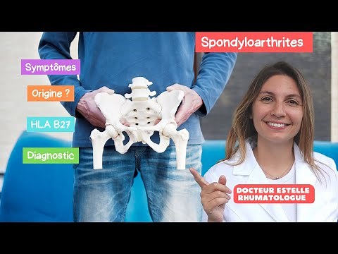 Ankylosing spondylitis rheumatologist explanations