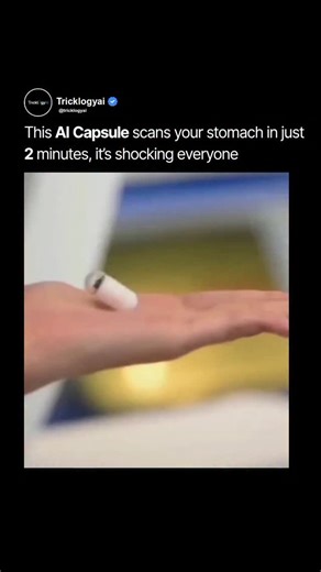 Tricklogyai on Instagram: "A capsule the size of a pill… but powerful enough to scan your entire stomach in under 2 minutes. This new AI-powered diagnostic capsule is designed to replace traditional endoscopy with a painless, fast, and non-invasive method. Once swallowed, it captures high-resolution images, sends them to a monitoring device, and helps doctors detect issues early — from inflammation to ulcers to internal bleeding. It’s a huge step forward for medical tech, especially for people w