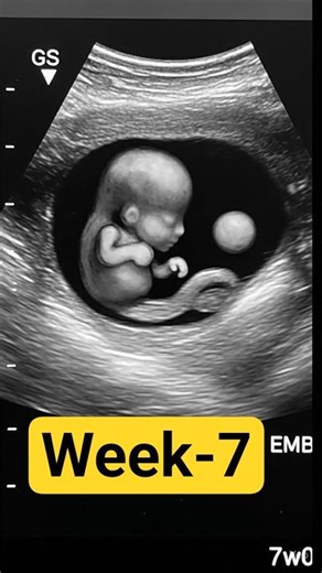 Week 7 Pregnancy Ultrasound | Baby’s Tiny Growth Inside Womb 👶 #Shorts