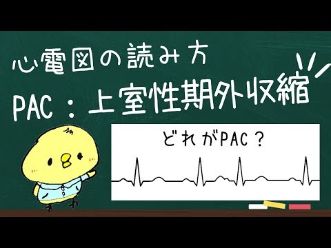 【心電図の読み方】上室性期外収縮の見分け方！PAC(心房性)について【医療従事者向け】