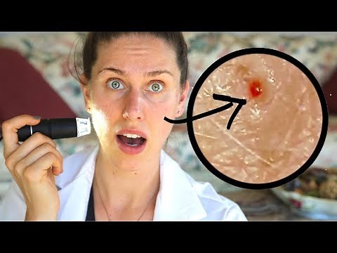 LOOKING AT MY ACNE / PORES UNDER A MICROSCOPE