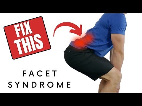 Lumbar Facet Joint Syndrome - How To Stretch & Exercise For Improved Back Pain Relief