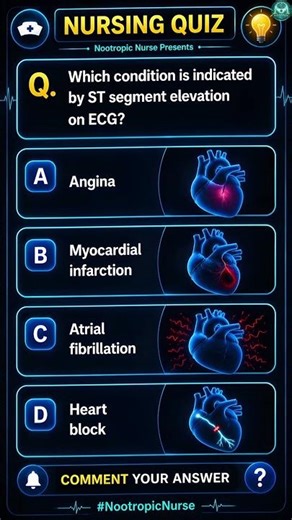 ST Segment Elevation ECG Quiz | Heart Conditions - Nootropic Nurse
