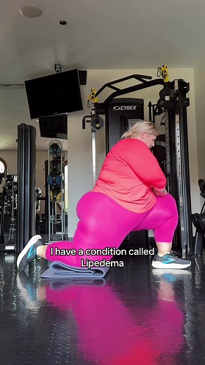 Lets talk about my body… #lipidema #healthylifestyle #plussize | lipedema