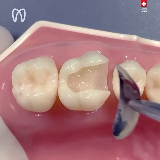 Dentistry | Via• @polydentia A short extract from the video of the new resilient and deformation resistant QuickmatFLEX sectional matrices. The... | Instagram