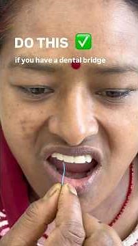 How to floss under a dental bridge?