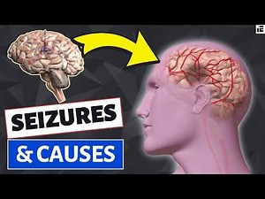 Understanding The Nine Common Causes Of Seizures