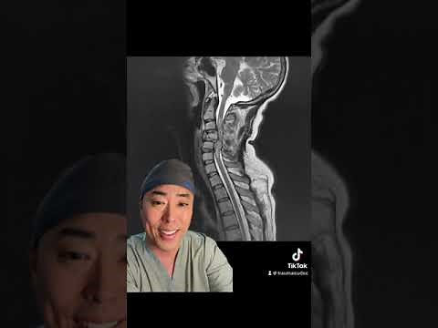 Neurogenic Shock: Pathophysiology & Therapy