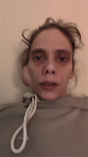 #abnormalgrowth #removal #tumor #fyp | lung tumors