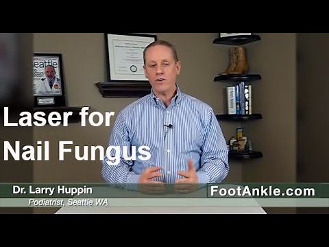 Laser for Toenail Fungus: Does it really work? By Seattle Podiatrist Larry Huppin