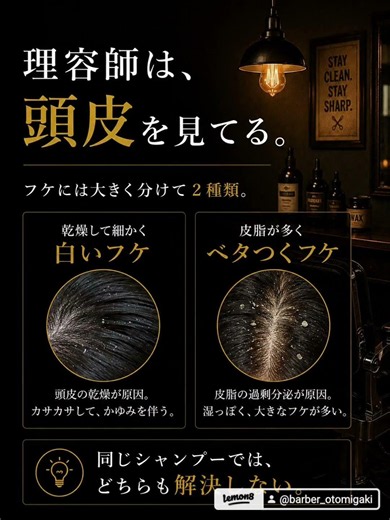 男のフケ対策は、シャンプーじゃない。理容師が教える本当の原因。