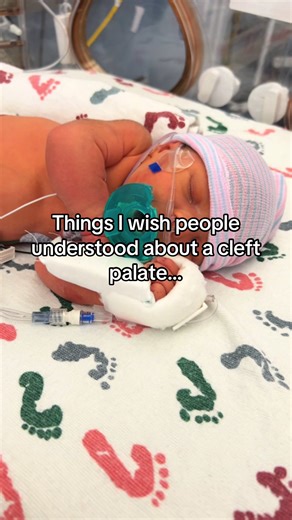 A cleft palate journey isn’t just surgeries and appointments. It’s feeding struggles, learning curves, and celebrating things others never have to think about. It’s explaining the same thing over and over—while protecting your child’s story. I share this not for sympathy, but for awareness. If this journey is new to you, welcome. If you’re living it too—you’re not alone. What’s something you wish people understood about your child’s journey?