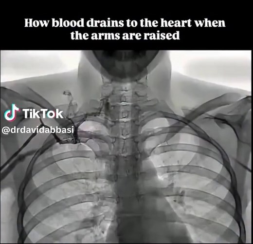 Understanding Blood Flow Changes When Arms Are Raised