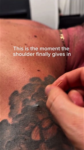 A trio of muscle twitches!