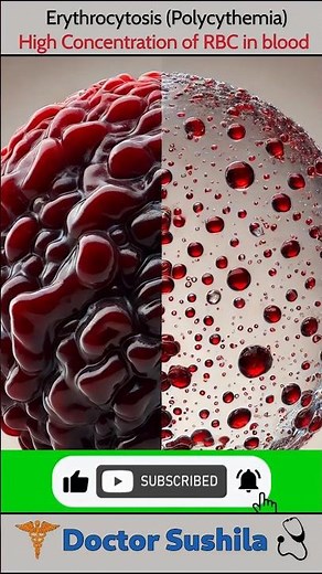 High level of RBC in Blood 😰 | Erythrocytosis (polycythemia) Explained 🤔| #rbc #erythrocytes #shorts