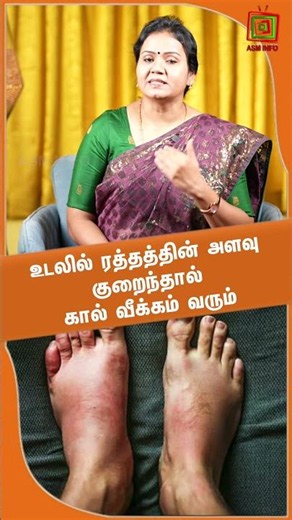 உடலில் ரத்தத்தின் அளவு குறைந்தால் கால் வீக்கம் வரும் | Dr. Jayaroopa | ASM INFO