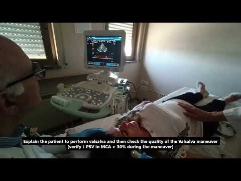 Bubble Test Using Transcranial Color-Coded Doppler (TCCD)