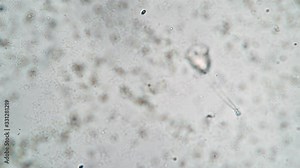 Fast compression of ciliate vorticella in which there is a spiral tail stalk. Theme of laboratory biological research under microscope. Microscopic protozoa in a drop of water under magnification.