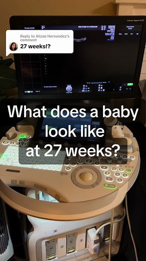 peekatbaby4d on TikTok