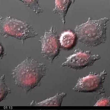 Anti-Fas-induced apoptotic L929 cells - Morphology, Lysotracker Red & SG uptake overlay
