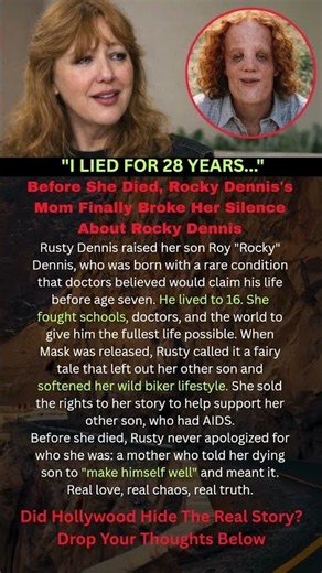The Truth Rocky Dennis' Mom Kept Until the End