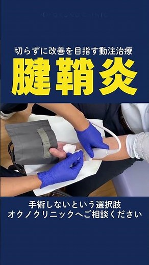 切らずに改善を目指す動注治療 腱鞘炎