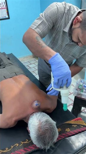 upper back and mid back or low back problem cupping therapy treatment