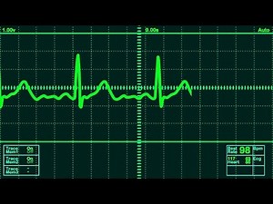 Video Tutorial : Heartbeat monitor over Bluetooth using Arduino