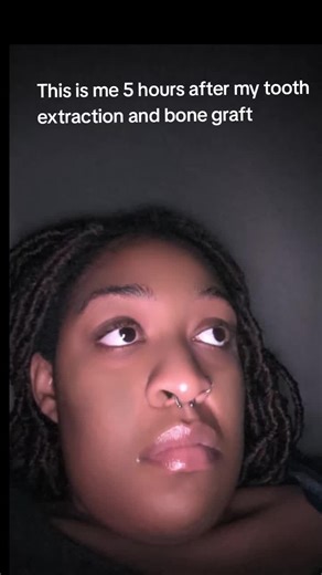 Post-Tooth Extraction Recovery Journey