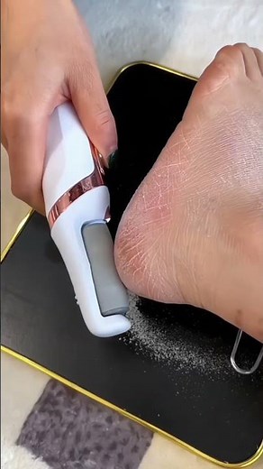 Soft Heels Instantly 🔥 | Dead Skin Remover