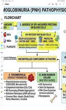 Paroxysmal Nocturnal Hemoglobinuria/ PNH / Hemolytic Anemia/ Pathology.#pnh #hemolyticanemia #neetpg