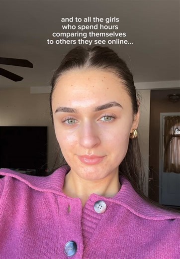 Embracing Real Skin: My Acne Journey and Insights