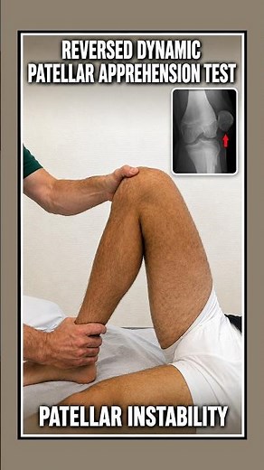 🦵 Reversed Dynamic Patellar Apprehension Test | Patellar Instability Physical Exam #kneepain #ATC