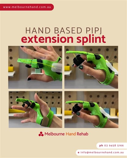 Custom-made static progressive finger splint our Occupational Therapist, Filion Zhu, from our Bulleen and Ivanhoe sites✨ If you or someone you know needs support with hand, wrist or muscle function, our team is here to help. 📞 9458 5166 🖱️ melbournehand.com.au/appointments | Melbourne Hand Rehab