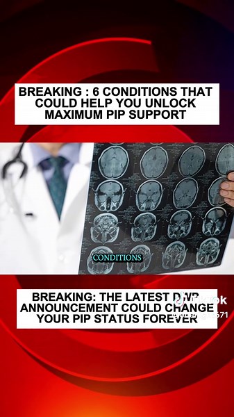 Unlock Maximum PIP Support: 6 Conditions Explained