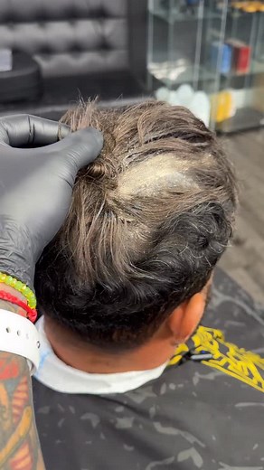 1.1K views · 35 reactions | Prótesis capilar(305)330-7851 #viral #reels #cambio #barbería #barber #protesis #tutorial #viralvideos | Carlos Soria | Facebook