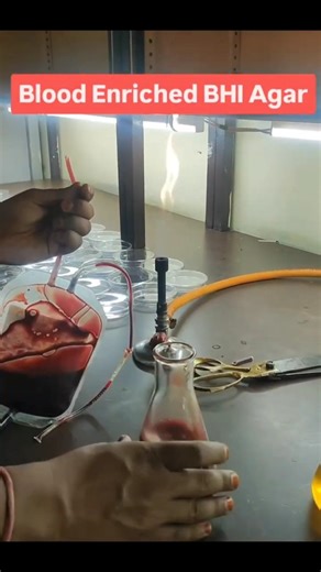 Blood Agar Kaise Banaye? Complete Procedure | Lab Practical 2026